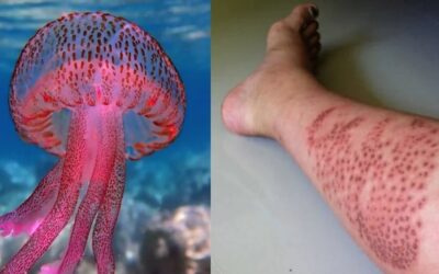 Προσοχή στις Μωβ μέδουσες: Χάρτης με τις επικίνδυνες περιοχές